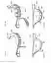 Fig. 14 - Horseman-securing device, saddle, and saddle securing device for preventing a horseman from falling off a four-legged animal