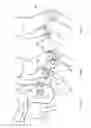 Fig. 17 - Horseman-securing device, saddle, and saddle securing device for preventing a horseman from falling off a four-legged animal