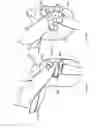 Fig. 20 - Horseman-securing device, saddle, and saddle securing device for preventing a horseman from falling off a four-legged animal