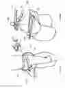 Fig. 44 - Horseman-securing device, saddle, and saddle securing device for preventing a horseman from falling off a four-legged animal