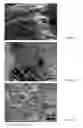 Fig. 04 - System and methods for fabricating boron nitride nanostructures