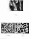 Fig. 02 - Porous calcium deficient hydroxyapatite granules