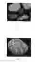 Fig. 03 - Porous calcium deficient hydroxyapatite granules