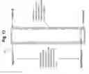 Fig. 14 - Purified silicon, devices and systems for producing same