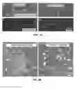 Fig. 11 - COMPOSITIONS AND METHODS FOR TREATING NEURODEGENERATIVE DISEASE