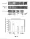 Fig. 16 - COMPOSITIONS AND METHODS FOR TREATING NEURODEGENERATIVE DISEASE