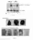 Fig. 18 - COMPOUNDS AND METHODS OF MODULATING ANGIOGENESIS