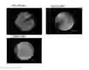 Fig. 09 - CRYSTALLIZATION METHODS FOR PURIFICATION OF MONOCLONAL ANTIBODIES