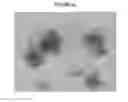Fig. 12 - CRYSTALLIZATION METHODS FOR PURIFICATION OF MONOCLONAL ANTIBODIES