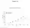 Fig. 25 - NOTCH BINDING AGENTS AND ANTAGONISTS AND METHODS OF USE THEREOF
