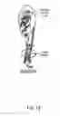 Fig. 03 - INFLUENZA VACCINES AND METHODS OF USE THEREOF