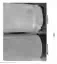 Fig. 02 - Solid Acid Scale Inhibitors