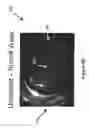 Fig. 04 - System and method for inhibiting scale formation in oil wells