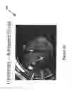 Fig. 05 - System and method for inhibiting scale formation in oil wells