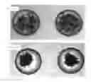 Fig. 10 - METHOD FOR MANUFACTURING MICRO-HEMISPHERE ARRAY PLATE, MICROFLUIDIC DEVICE COMPRISING MICRO-HEMISPHERE ARRAY PLATE, AND METHOD FOR CULTURING CELL AGGREGATE USING SAME