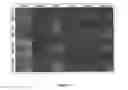 Fig. 03 - Induced pluripotent cell-derived oligodendrocyte progenitor cells for the treatment of myelin disorders