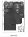 Fig. 05 - Induced pluripotent cell-derived oligodendrocyte progenitor cells for the treatment of myelin disorders