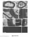 Fig. 12 - Induced pluripotent cell-derived oligodendrocyte progenitor cells for the treatment of myelin disorders