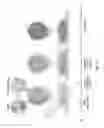 Fig. 02 - Encapsulation and cardiac differentiation of hiPSCs in 3D PEG-fibrinogen hydrogels