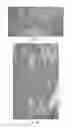 Fig. 11 - Encapsulation and cardiac differentiation of hiPSCs in 3D PEG-fibrinogen hydrogels
