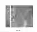 Fig. 12 - Encapsulation and cardiac differentiation of hiPSCs in 3D PEG-fibrinogen hydrogels