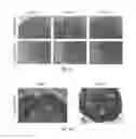Fig. 16 - Encapsulation and cardiac differentiation of hiPSCs in 3D PEG-fibrinogen hydrogels