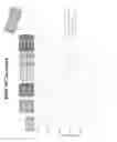 Fig. 126 - Methods for isolating microvesicles and extracting nucleic acids from biological samples