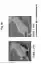 Fig. 12 - COMPOSITION FOR TREATING CANCER ASSOCIATED WITH HPV INFECTION