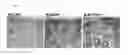 Fig. 04 - Preventive or therapeutic agent for fibrosis
