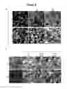 Fig. 06 - Bacteria-based protein delivery
