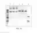 Fig. 17 - Compositions and methods for analyzing modified nucleotides