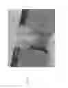 Fig. 18 - Chemical functionalization of solid-state nanopores and nanopore arrays and applications thereof