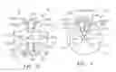 Fig. 04 - Suspension Plasma Spray Apparatus and Use Methods
