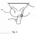 Fig. 04 - Helical drain for a toilet