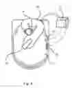 Fig. 05 - Helical drain for a toilet