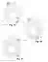 Fig. 08 - POSITIVE CEMENT PLACEMENT TOOL