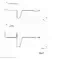 Fig. 08 - Method for controlling a pump arrangement