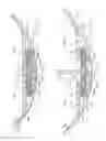 Fig. 05 - Expandable sealing mechanism