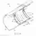 Fig. 13 - Expandable sealing mechanism