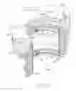 Fig. 14 - Expandable sealing mechanism