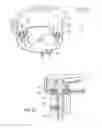 Fig. 11 - Support for pendant clusters