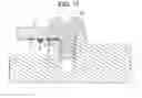 Fig. 12 - BATTERY SENSOR DEVICE