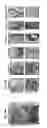 Fig. 16 - Whole-body tissue stabilization and selective extractions via tissue-hydrogel hybrids for high resolution intact circuit mapping and phenotyping