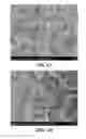 Fig. 07 - Microfluidic device and method for analysis of tumor cell microenvironments