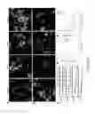 Fig. 11 - DEVICE AND METHOD FOR ASSESSING CELL CONTRACTION