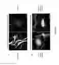 Fig. 12 - DEVICE AND METHOD FOR ASSESSING CELL CONTRACTION