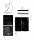 Fig. 14 - DEVICE AND METHOD FOR ASSESSING CELL CONTRACTION