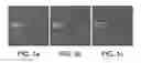 Fig. 02 - COMPOSITIONS AND METHODS FOR THE DIAGNOSIS OF SYSTEMIC AUTOIMMUNE DISEASE