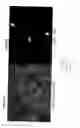 Fig. 09 - Methods of selecting retinal pigmented epithelial cells