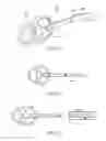 Fig. 13 - Devices and assays for diagnosis of sinusitis
